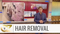 If You’re Considering Laser Hair Removal, Use This Safety Checklist 