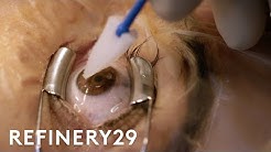 What Getting Laser Eye Surgery Is Really Like | Macro Beauty | Refinery29 