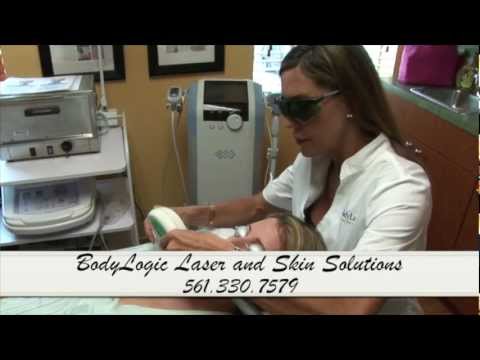 Delray Beach Beauty Health Care, Delray Laser Hair Removal, Thermage Delray Beach 