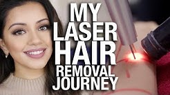 My Laser Hair Removal Journey 